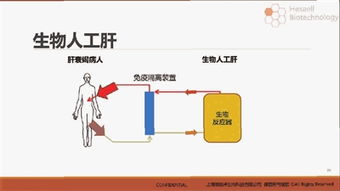 人工肝醫(yī)保 人工肝治療費(fèi)用
